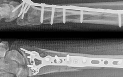 Rest Of My Life: Titan hand